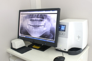 X線写真:顎の骨密度を測る